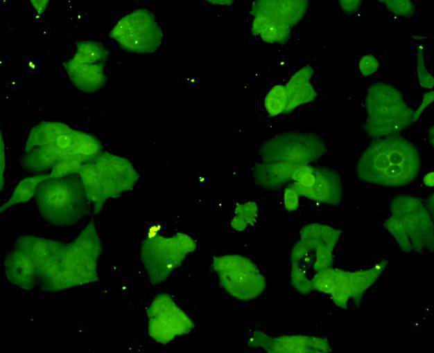 ICC staining Ubiquitin in Hela cells (green).  Cells were fixed in paraformaldehyde, permeabilised with 0.25% Triton X100/PBS.