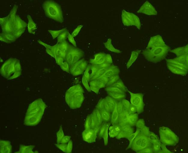 ICC staining CDk1 in Hela cells (green). Cells were fixed in paraformaldehyde, permeabilised with 0.25% Triton X100/PBS.