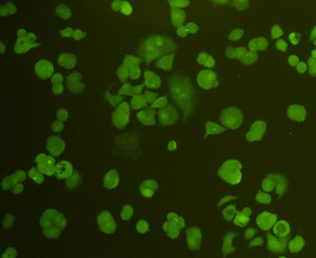 ICC staining CDk1 in MCF-7 cells (green). Cells were fixed in paraformaldehyde, permeabilised with 0.25% Triton X100/PBS.