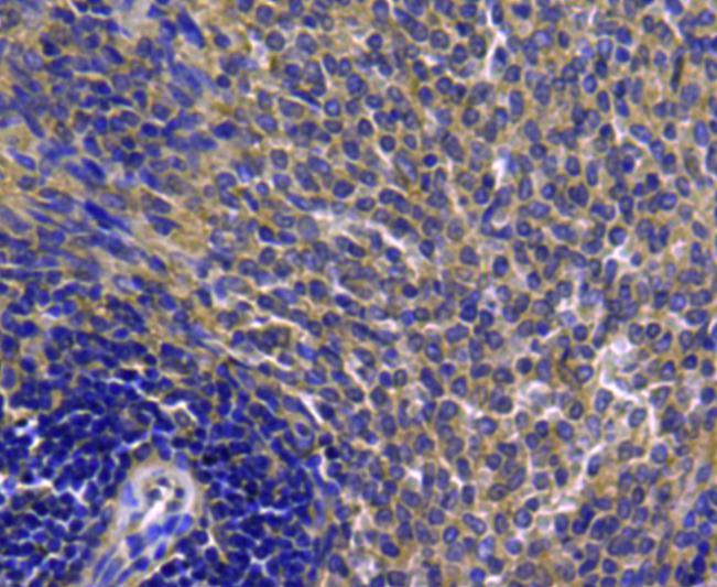 Immunohistochemical analysis of paraffin-embedded rat spleen tissue using anti-CDk1 antibody. Counter stained with hematoxylin.