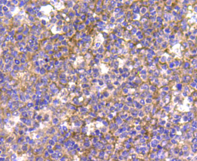 Immunohistochemical analysis of paraffin-embedded human tonsil tissue using anti-CDk1 antibody. Counter stained with hematoxylin