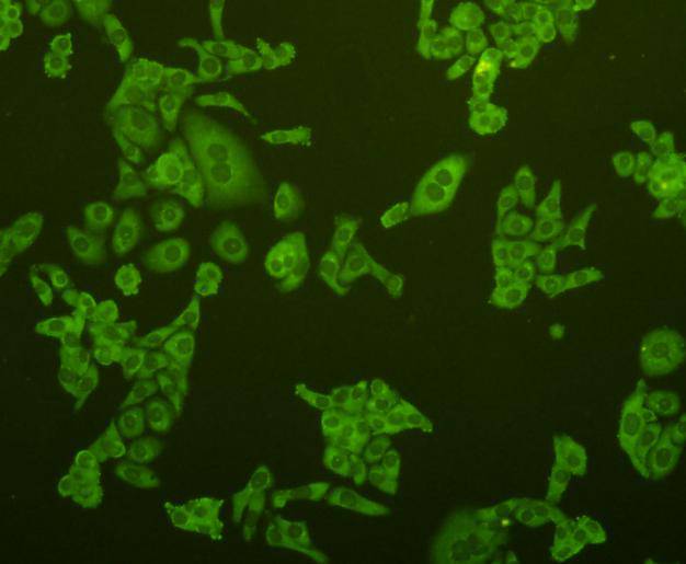 ICC staining PUMA in SKOV-3 cells (green). Cells were fixed in paraformaldehyde, permeabilised with 0.25% Triton X100/PBS.