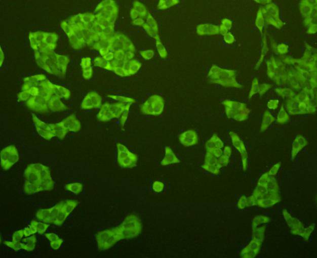 ICC staining PUMA in Hela cells (green). Cells were fixed in paraformaldehyde, permeabilised with 0.25% Triton X100/PBS.