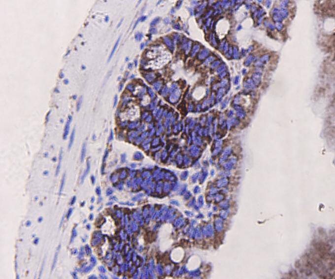 Immunohistochemical analysis of paraffin-embedded mouse small intestine tissue using anti-PUMA antibody. Counter stained with hematoxylin.