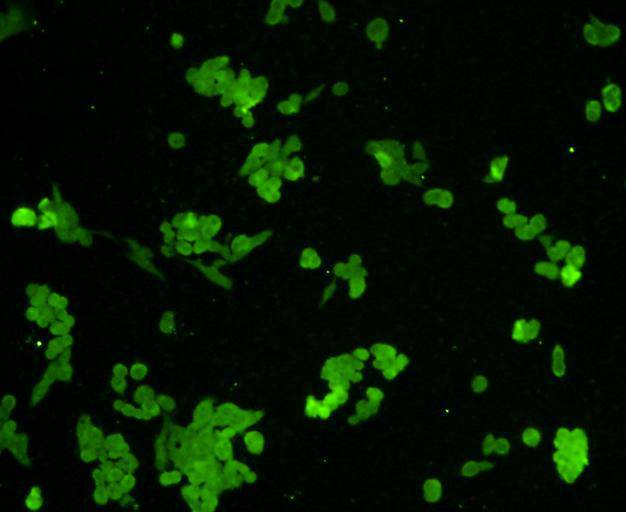 ICC staining Hsp27 in Lovo cells (green). Cells were fixed in paraformaldehyde, permeabilised with 0.25% Triton X100/PBS.