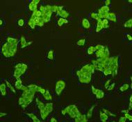 ICC staining CD31 in Hela cells (green). Cells were fixed in paraformaldehyde, permeabilised with 0.25% Triton X100/PBS.