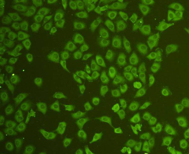 ICC staining CD31 in HUVEC cells (green). Cells were fixed in paraformaldehyde, permeabilised with 0.25% Triton X100/PBS.