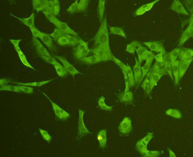 ICC staining CD31 in NIH/3T3 cells (green). Cells were fixed in paraformaldehyde, permeabilised with 0.25% Triton X100/PBS.