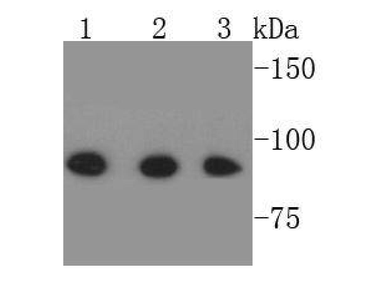 Western blot analysis of Stat-1α/β on different cell lysates using anti-Stat-1α/β antibody at 1/500 dilution.<br />
Positive control:   <br />
Lane 1: Hela cell lysate           <br />
Lane 2: NIH/3T3 cell lysate <br />
Lane 3: MCF-7 cell lysate