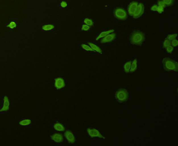 ICC staining Stat-1α/β in HepG2 cells (green). Cells were fixed in paraformaldehyde, permeabilised with 0.25% Triton X100/PBS.