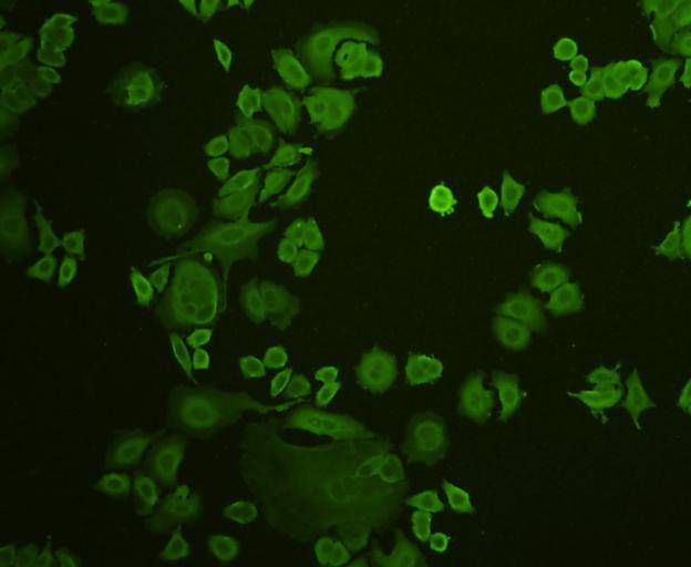 ICC staining Stat-1α/β in MCF-7 cells (green). Cells were fixed in paraformaldehyde, permeabilised with 0.25% Triton X100/PBS.