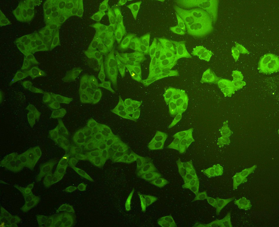 ICC staining Stat-1α/β in Hela cells (green). Cells were fixed in paraformaldehyde, permeabilised with 0.25% Triton X100/PBS.