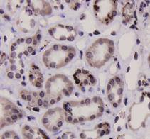 Immunohistochemical analysis of paraffin-embedded human kidney tissue using anti-Stat-1α/β antibody. Counter stained with hematoxylin.