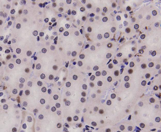 Immunohistochemical analysis of paraffin-embedded mouse kidney tissue using anti-Stat-1α/β antibody. Counter stained with hematoxylin.