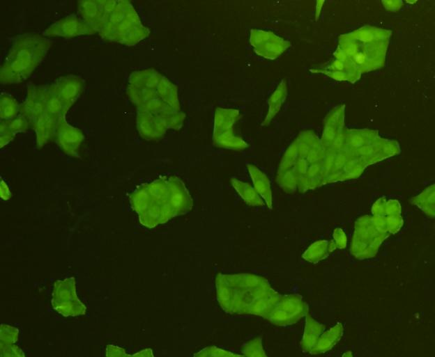 ICC staining CDK6 in Hela cells (green). Cells were fixed in paraformaldehyde, permeabilised with 0.25% Triton X100/PBS.