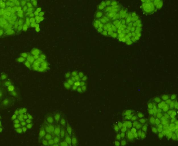ICC staining CDK6 in HepG2 cells (green). Cells were fixed in paraformaldehyde, permeabilised with 0.25% Triton X100/PBS.