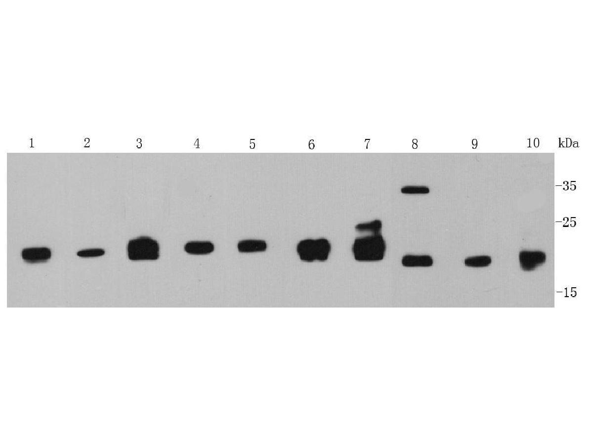 Western blot analysis of MGMT on different lysates using anti- MGMT antibody at 1/1,000 dilution.<br />
Positive control:   <br />
Lane 1: Hela cell lysate          <br />
Lane 2: MCF-7 cell lysate <br />
Lane 3: Daudi cell lysate         <br />
Lane 4: Raji cell lysate <br />
Lane 5: SK-BR-3 cell lysate       <br />
Lane 6: SKOV3 cell lysate <br />
Lane 7: Human liver tissue lysate    <br />
Lane 8: Human kidney tissue lysate <br />
Lane 9: Human thymus tissue lysate   <br />
Lane 10: Human placentae tissue lysate