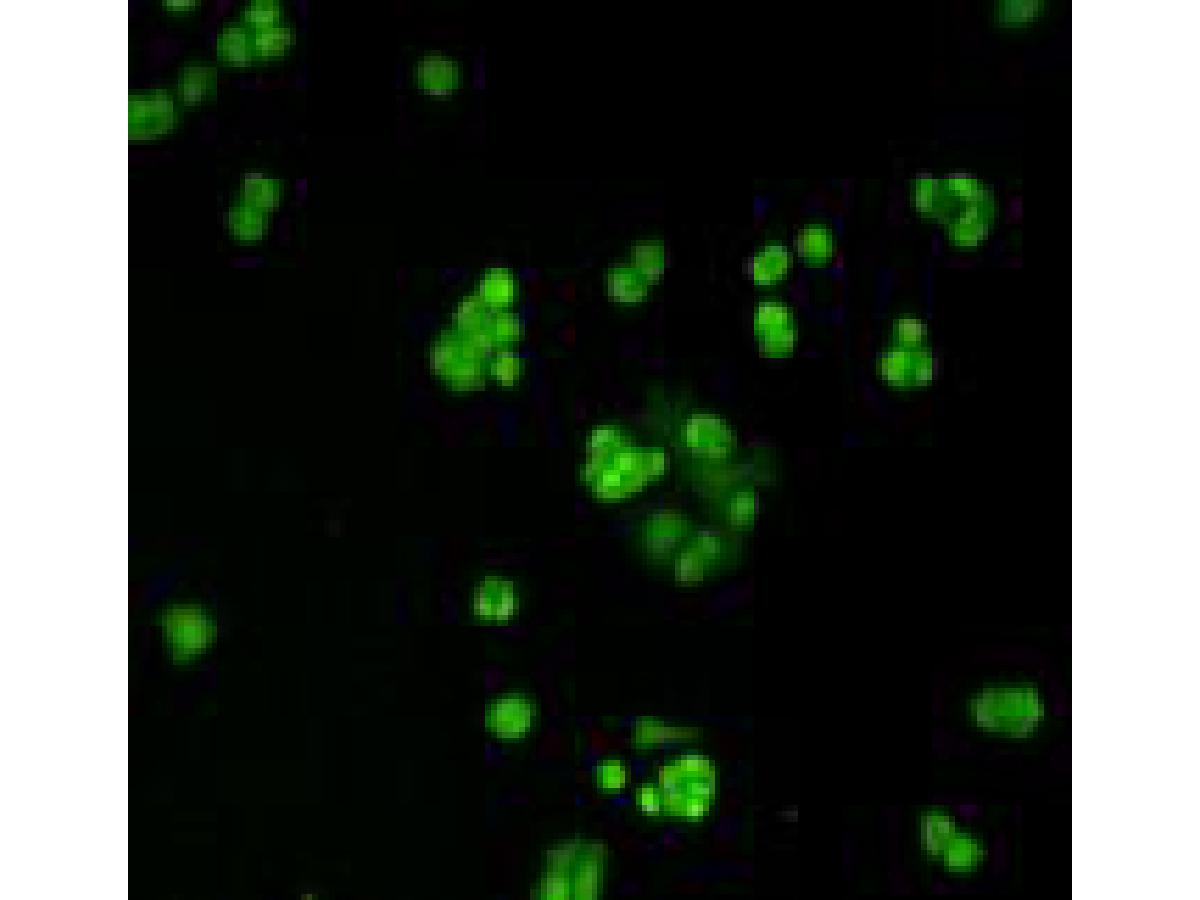 ICC staining MGMT in SK-BR-3 cells (green).  Cells were fixed in paraformaldehyde, permeabilised with 0.25% Triton X100/PBS.