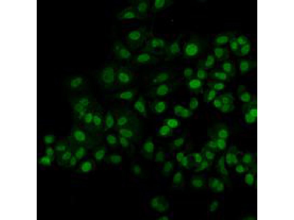 ICC staining MGMT in MCF-7 cells (green).  Cells were fixed in paraformaldehyde, permeabilised with 0.25% Triton X100/PBS.