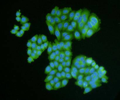 ICC staining of Desmin in HepG2 cells (green). Cells were fixed in paraformaldehyde, permeabilised with 0.25% Triton X100/PBS.