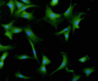 ICC staining of Desmin in NIH-3T3 cells (green). Cells were fixed in paraformaldehyde, permeabilised with 0.25% Triton X100/PBS.