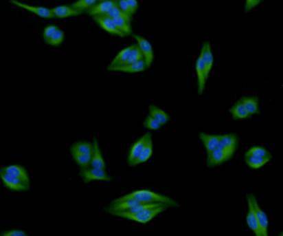 ICC staining of Desmin in Hela cells (green). Cells were fixed in paraformaldehyde, permeabilised with 0.25% Triton X100/PBS.