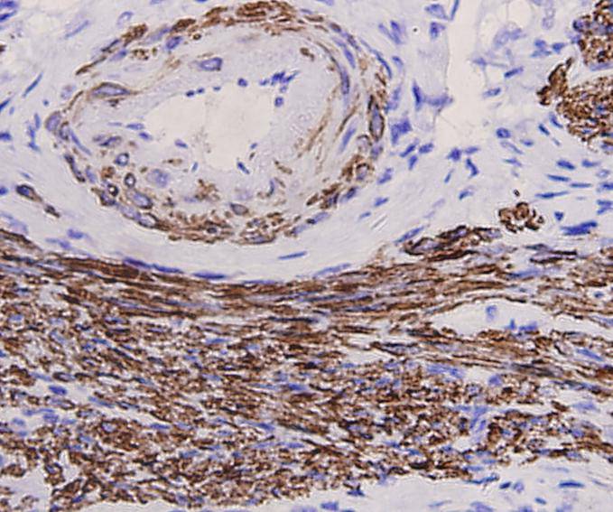 Immunohistochemical analysis of paraffin-embedded mouse skeletal muscle tissue using anti-Desmin antibody. Counter stained with hematoxylin.