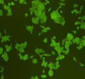 ICC staining Ras in HCT116 cells (green). Cells were fixed in paraformaldehyde, permeabilised with 0.25% Triton X100/PBS.