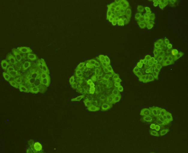 ICC staining Ras in HepG2 cells (green). Cells were fixed in paraformaldehyde, permeabilised with 0.25% Triton X100/PBS.