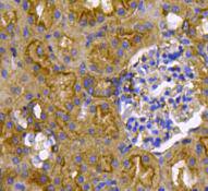 Immunohistochemical analysis of paraffin-embedded mouse kidney tissue using anti-Ras antibody. Counter stained with hematoxylin.