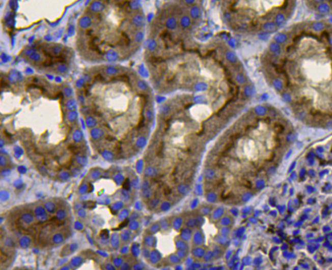 Immunohistochemical analysis of paraffin-embedded human kidney muscle tissue using anti-Ras antibody. Counter stained with hematoxylin.