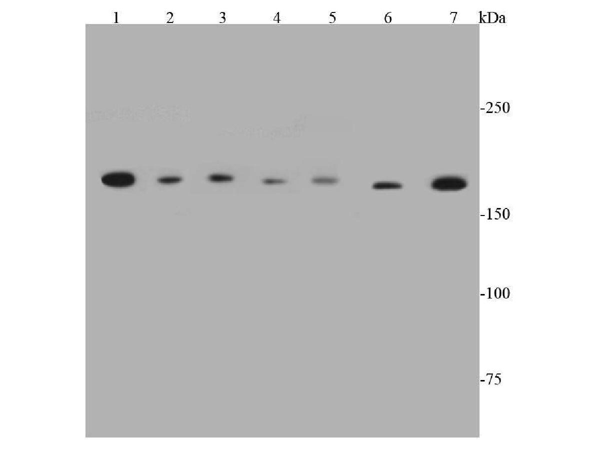 Western blot analysis of TOP2A on different lysates using anti-TOP2A antibody at 1/500 dilution.<br />
Positive control: <br />
Lane 1: Jurkat cell lysate <br />
Lane 2: NIH/3T3 cell lysate <br />
Lane 3: A431 cell lysate <br />
Lane 4: L929 cell lysate <br />
Lane 5: A549 cell lysate<br />
Lane 6: Human liver tissue lysate<br />
Lane 7: HUVEC cell lysate