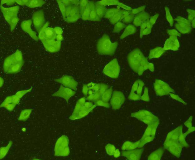 ICC staining TOP2A in Hela cells (green). Cells were fixed in paraformaldehyde, permeabilised with 0.25% Triton X100/PBS.