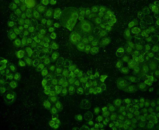 ICC staining TOP2A in A431 cells (green). Cells were fixed in paraformaldehyde, permeabilised with 0.25% Triton X100/PBS.