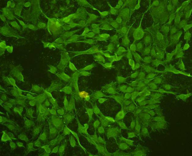ICC staining TOP2A in NIH/3T3 cells (green). Cells were fixed in paraformaldehyde, permeabilised with 0.25% Triton X100/PBS.