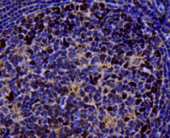 Immunohistochemical analysis of paraffin-embedded human tonsil tissue using anti-TOP2A antibody. Counter stained with hematoxylin.