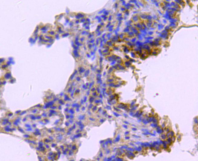 Immunohistochemical analysis of paraffin-embedded rat lung tissue using anti-catalase antibody. Counter stained with hematoxylin.