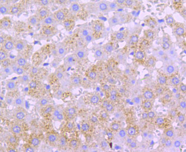 Immunohistochemical analysis of paraffin-embedded rat liver tissue using anti-catalase antibody. Counter stained with hematoxylin.