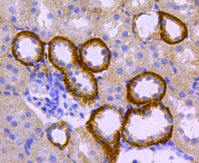 Immunohistochemical analysis of paraffin-embedded rat kidney tissue using anti-catalase antibody. Counter stained with hematoxylin.