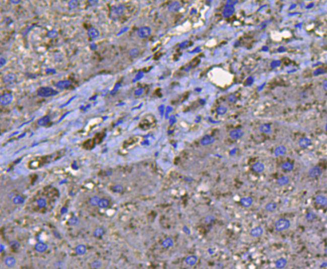 Immunohistochemical analysis of paraffin-embedded human liver tissue using anti-catalase antibody. Counter stained with hematoxylin.
