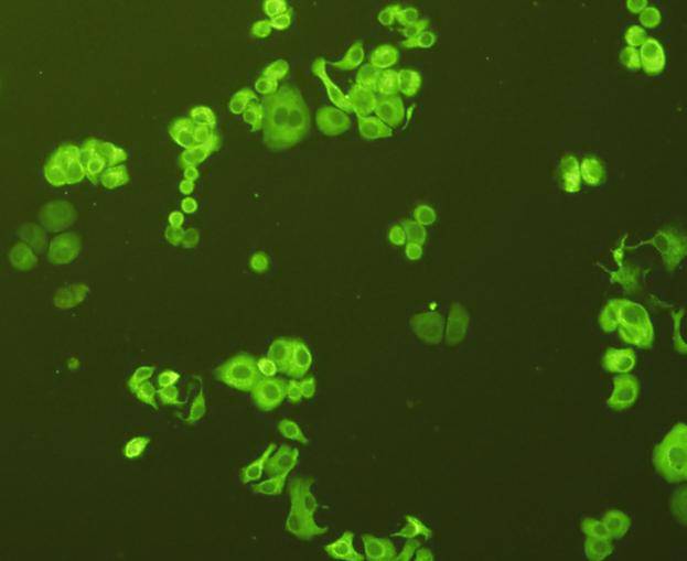 ICC staining of GRP78 in SK-Br-3 cells (green). Formalin fixed cells were permeabilized with 0.1% Triton X-100 in TBS for 10 minutes at room temperature and blocked with 10% negative goat serum for 15 minutes at room temperature. Cells were probed with the primary antibody (ER40402, 1/50) for 1 hour at room temperature, washed with PBS. Alexa Fluor®488 conjugate-Goat anti-Rabbit IgG was used as the secondary antibody at 1/1,000 dilution. The nuclear counter stain is DAPI (blue).