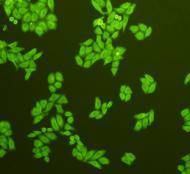 ICC staining of GRP78 in HepG2 cells (green). Formalin fixed cells were permeabilized with 0.1% Triton X-100 in TBS for 10 minutes at room temperature and blocked with 10% negative goat serum for 15 minutes at room temperature. Cells were probed with the primary antibody (ER40402, 1/50) for 1 hour at room temperature, washed with PBS. Alexa Fluor®488 conjugate-Goat anti-Rabbit IgG was used as the secondary antibody at 1/1,000 dilution. The nuclear counter stain is DAPI (blue).