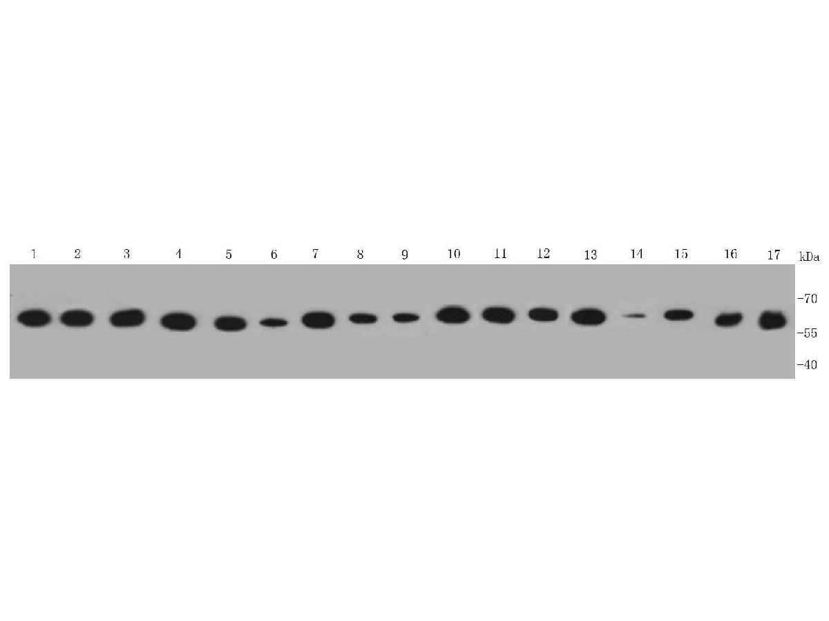 Western blot analysis of PDI on different lysates using anti- PDI antibody at 1/1,000 dilution.<br />
Positive control:   <br />
Lane 1: Hela cell lysate<br />
Lane 2: MCF-7 cell lysate<br />
Lane 3: PANC cell lysate<br />
Lane 4: HepG2 cell lysate<br />
Lane 5: HUVEC cell lysate<br />
Lane 6: NIH/3T3 cell lysate<br />
Lane 7: L929 cell lysate<br />
Lane 8: F9 cell lysate<br />
Lane 9: Jurkat cell lysate<br />
Lane 10: A431 cell lysate<br />
Lane 11: A549 cell lysate<br />
Lane 12: Mouse liver tissue lysate<br />
Lane 13: Mouse kidney tissue lysate<br />
Lane 14: Mouse brain tissue lysate<br />
Lane 15: Human kidney tissue lysate<br />
Lane 16: Human brain tissue lysate<br />
Lane 17: Human liver tissue lysate
