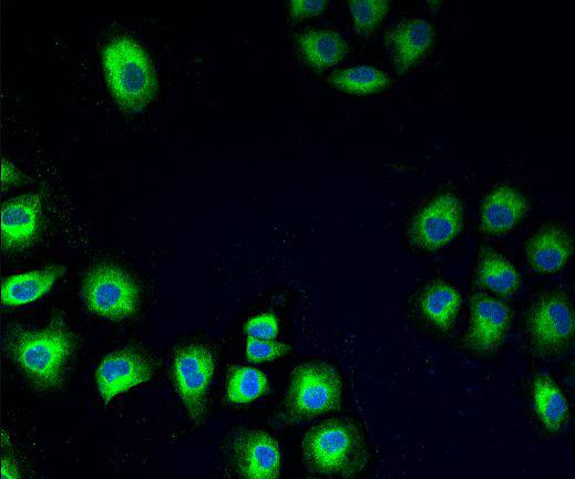 ICC staining PDI in HUVEC cells (green). The nuclear counter stain is DAPI (blue). Cells were fixed in paraformaldehyde, permeabilised with 0.25% Triton X100/PBS.