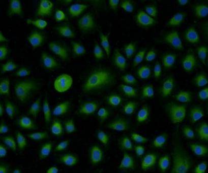 ICC staining PDI in A549 cells (green). The nuclear counter stain is DAPI (blue). Cells were fixed in paraformaldehyde, permeabilised with 0.25% Triton X100/PBS.