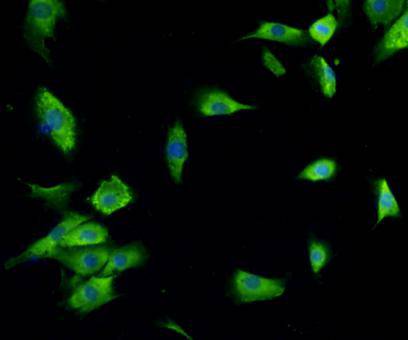 ICC staining PDI in NIH/3T3 cells (green). The nuclear counter stain is DAPI (blue). Cells were fixed in paraformaldehyde, permeabilised with 0.25% Triton X100/PBS.