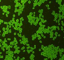 ICC staining cMet in N2A cells (green). Cells were fixed in paraformaldehyde, permeabilised with 0.25% Triton X100/PBS.
