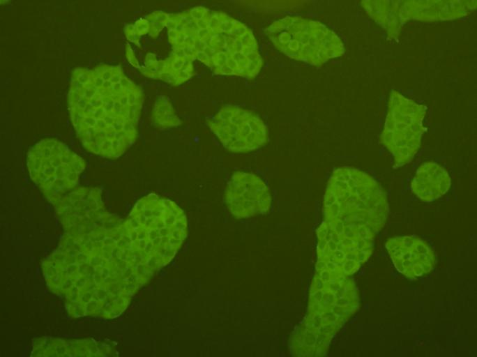 ICC staining cMet in Hela cells (green). Cells were fixed in paraformaldehyde, permeabilised with 0.25% Triton X100/PBS.