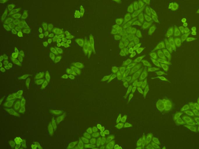 ICC staining cMet in HepG2 cells (green). Cells were fixed in paraformaldehyde, permeabilised with 0.25% Triton X100/PBS.