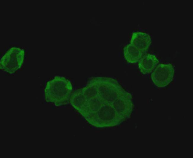 ICC staining HSP70 in SKBR-3 cells (green). Cells were fixed in paraformaldehyde, permeabilised with 0.25% Triton X100/PBS.